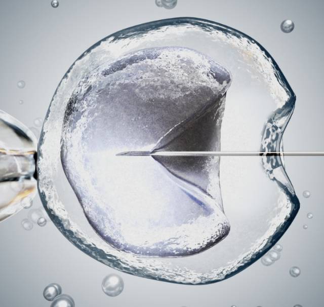 reproductive medicine, image of IVF research